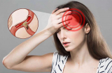 5 nguy cơ của bệnh thiếu máu não và cách phòng ngừa
