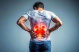 5 biểu hiện xuất hiện vào ban đêm cảnh báo suy thận, đừng chủ quan kẻo chạy thận cả đời
