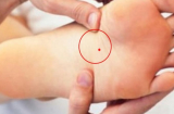 4 nốt ruồi ở chỗ kín hút tài lộc: Đừng dại xóa đi
