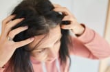 Tóc bạc nhiều hay ít có liên quan đến tuổi thọ? Bác sĩ nói ra sự thật khiến nhiều người bất ngờ