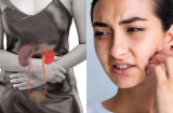 5 dấu hiệu trên mặt cảnh báo suy thận đang âm thầm xảy ra