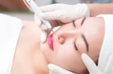 Chăm sóc da sau khi tẩy nốt ruồi: 5 nguyên tắc giúp da hồi phục nhanh, hạn chế thâm sẹo