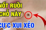 4 nốt ruồi hao tài, nên hóa giải kẻo hao tài khánh kiệt