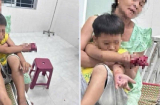 Cháu bé bị dập bàn tay nghi do điện thoại nổ khi đang sạc pin