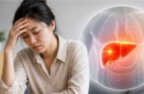  
Những tín hiệu nhỏ báo bệnh gan, chớ chủ quan