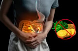 Người bị 5 bệnh này không nên ăn dứa