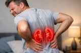 5 biểu hiện về đêm cảnh báo suy thận giai đoạn 1: Đi khám ngay kẻo chạy thận cả đời