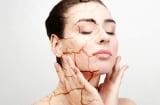 Nắng nóng đỉnh điểm khiến da dễ cháy nắng: Cách bảo vệ và phục hồi da đúng cách
