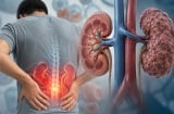4 loại đồ uống làm tăng gánh nặng cho thận, nhiều người Việt vẫn dùng thường xuyên