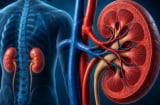  Dấu hiệu Sh88bet đăng ký miễn phí cảnh báo bệnh thận nhưng nhiều người bỏ qua