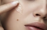 5 cách hỗ trợ làm mờ thâm lâu năm, giúp Mừng SHBET phiên bản mới 2025 đều màu và rạng rỡ hơn
