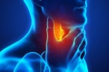 5 dấu hiệu ung thư tuyến giáp giai đoạn 1: Phát hiện sớm có thể kéo dài sự sống