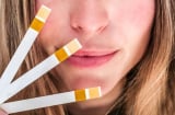 Bí quyết duy trì Mừng SHBET phiên bản mới 2025 khỏe mạnh và hạn chế lão hóa từ hàng rào bảo vệ tự nhiên