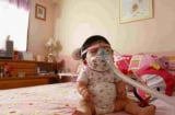 Điều gì khiến thế giới phải thán phục cô gái 17 tuổi trong thân hình trẻ sơ sinh?