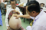 Bụng to nhìn như bầu 9 tháng, người phụ nữ ngã ngửa khi phát hiện...