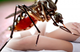 Nóng:  Chàng trai 20 tuổi nhiễm virus Zika do quan hệ tình dục