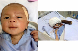 Hình ảnh mới nhất và tình hình sức khỏe khi tròn 17 tháng tuổi của bé trai bị dao dâm xuyên não