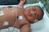 Bé sơ sinh nặng 6,3kg to gấp đôi so với trẻ sơ sinh bình thường khiến nhiều người kinh ngạc