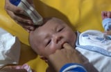 Vụ bé trai bị đâm xuyên sọ lúc 11 ngày tuổi: Xuất hiện kì tích bất ngờ ngay trước ca mổ
