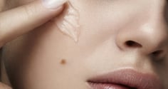 5 cách hỗ trợ làm mờ thâm lâu năm, giúp Mừng SHBET phiên bản mới 2025 đều màu và rạng rỡ hơn
