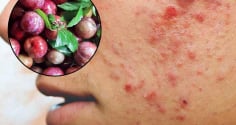 3 đối tượng không được ăn mận: Dễ nổi mụn, nóng trong