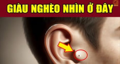 3 nốt ruồi hao tài lận đận tình duyên