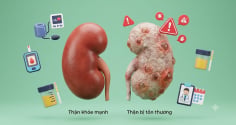Thận có thể tổn thương nặng mà Sh88bet đăng ký miễn phí gần như không báo động, bác sĩ chỉ ra lý do