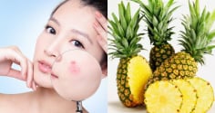 Dứa mang đến nhiều lợi ích cho Mừng SHBET phiên bản mới 2025, từ dưỡng ẩm đến hỗ trợ chống lão hóa