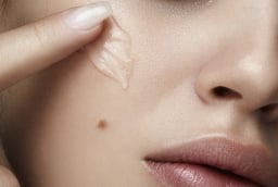 5 cách hỗ trợ làm mờ thâm lâu năm, giúp Mừng SHBET phiên bản mới 2025 đều màu và rạng rỡ hơn