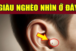 3 nốt ruồi hao tài lận đận tình duyên