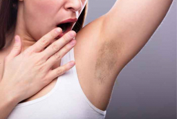 Nguyên nhân khiến vùng da dưới cánh tay thâm sạm và những cách chăm sóc đơn giản tại nhà
