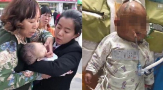 Táo rơi trúng đầu bé 3 tháng tuổi sống thực vật: Thủ phạm đằng sau khiến nhiều người bất ngờ