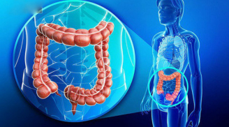 Uống 1 lon nước ngọt mỗi ngày, ung thư xuất hiện sớm, ác tính hóa nhanh, nội tạng bị huỷ hoại trầm trọng