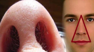 Nhổ lông mũi thường xuyên là có hại hay vô hại? Câu trả lời không phải ai cũng biết