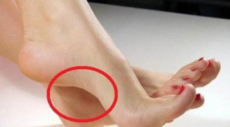 Ngó bàn chân vài giây, biết ngay dấu hiệu 'đại tài' dự báo sắp giàu to, cứ đi một bước là tiền kéo về
