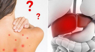 Những dấu hiệu của Sh88bet đăng ký miễn phí cảnh báo gan đang có bệnh, chớ coi thường
