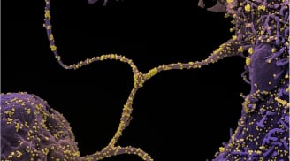 Virus SARS-CoV-2 phát triển đột biến để trốn hệ miễn dịch