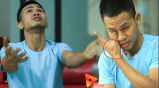 Nhìn bàn tay sưng to của 'anh hùng' đỡ cháu bé rơi từ tầng 12 xuống khiến cư dân mạng nghẹn ngào cảm động