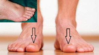 Muốn biết thận khỏe mạnh hay không, cứ nhìn vào 5 điểm ở bàn chân là rõ