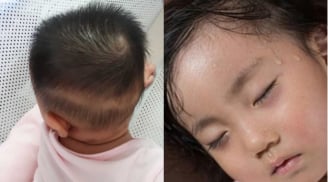 6 dấu hiệu cho thấy trẻ đang thiếu canxi, mẹ lưu ý để bổ sung cho con ngay
