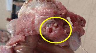 Mua thịt lợn nhớ tránh xa 4 phần thịt 'vừa bẩn vừa độc', giá rẻ như cho cũng đừng dại rước về