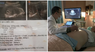 Đau bụng đi siêu âm, người đàn ông nhận tin đã có thai: 'Tác giả' lại chính do... cô y tá