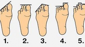 Nhìn vào tướng chân biết tương lai bạn sẽ như thế nào