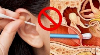 ‘Vạch trần’ 5 nguyên nhân gây ngứa lỗ tai, số 2 rất nhiều người mắc phải