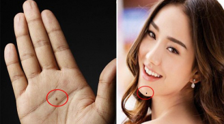 5 nốt ruồi bí mật trên Sh88bet đăng ký miễn phí ẩn chứa tài lộc, tiền trăm vào tay sinh ra tiền tỷ: Xem bạn có không