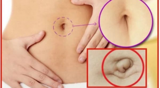 Người vượng tướng, vận số tốt thường sở hữu 3 kiểu rốn này, có 1/3 cũng đủ dư dả, viên mãn trọn đời