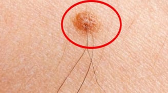 Lông mọc 4 vị trí này điềm báo phát tài, ngồi không hưởng lộc: Phúc lớn không thành tỷ phú cũng là đại gia