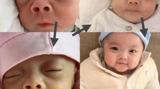 4 chỗ này của trẻ sơ sinh càng xấu thì lớn lên càng dễ 'lột xác' hóa 'thiên nga' nhanh chóng