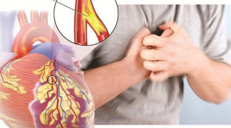 4 dấu hiệu Sh88bet đăng ký miễn phí nhắc bạn hãy cẩn thận kẻo bệnh tim mạch ghé thăm