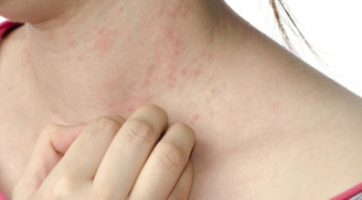 2 chỗ trên Sh88bet đăng ký miễn phí thường xuyên ngứa ngáy là biểu hiện của bệnh gan, nhiều người tưởng dị ứng